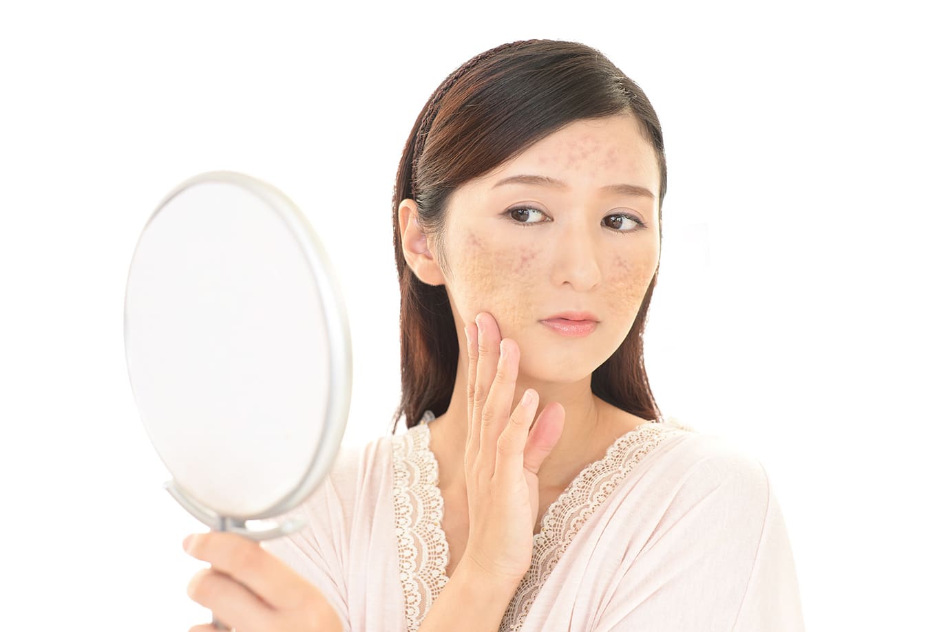 5 questions on acne scars singapore