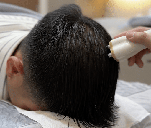 Hair loss treatment - Pulsed Magnetic Hair Radiofrequency