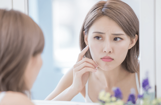 types and treatment of acne scar